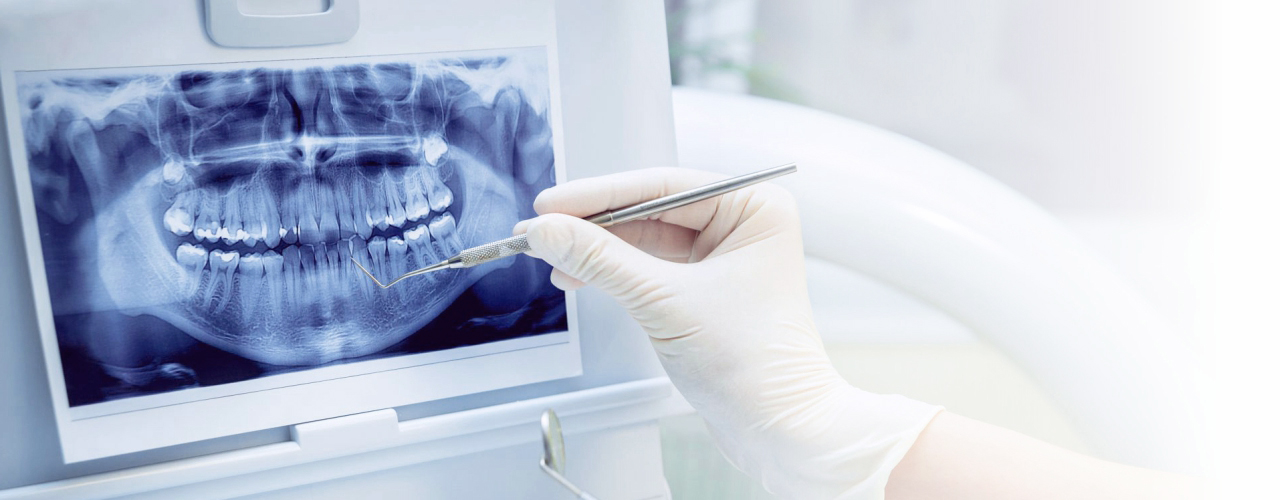 Ортопантомография (панорамный снимок зубов)