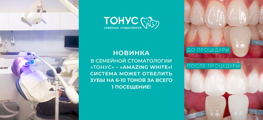 Новинка в семейной стоматологии «Тонус» –«Amazing White»!