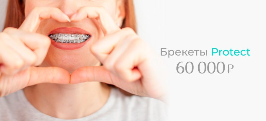 Безлигатурная брекет-система Protect на обе челюсти всего за 60 000 рублей!